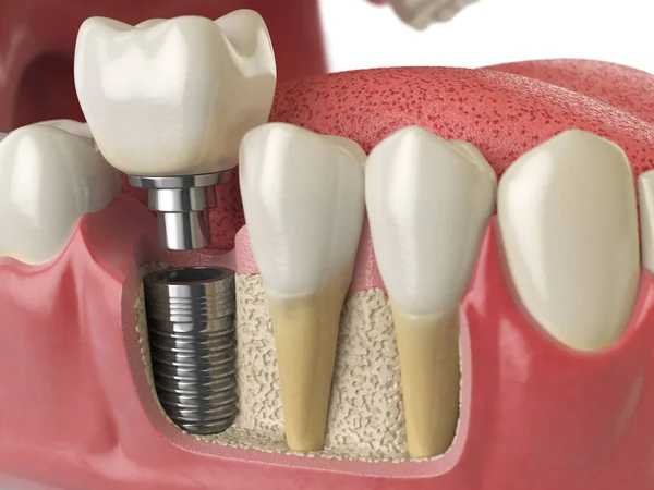 depositphotos 180159252 stock photo anatomy of healthy teeth and
