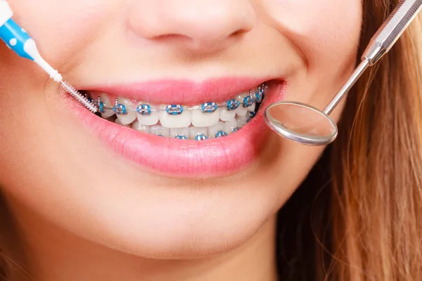 depositphotos 335248826 stock photo woman smiling cleaning teeth with