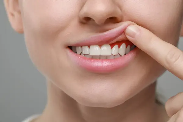 depositphotos 691703100 stock photo woman showing inflamed gum grey