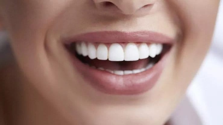 estetik diş hekimliği sonrası dikkat edilmesi gerekenler