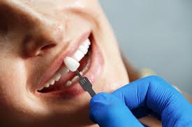 aesthetic dentistry process in kadıköy