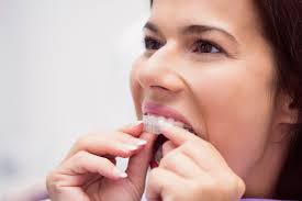 dental straightening treatment options in kadıköy