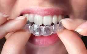 dentist in kadıköy who performs clear aligner treatment.