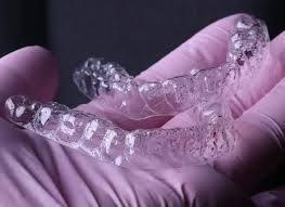 digital orthodontics applications in kadıköy