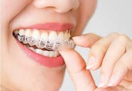how does the invisalign process work in kadıköy