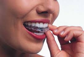how does wireless orthodontics work in kadıköy