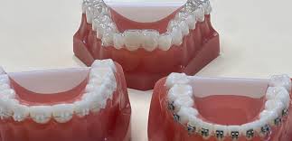 oral care in orthodontic treatment in kadıköy