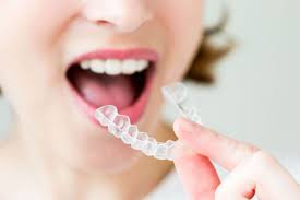 what is clear aligner treatment in kadıköy